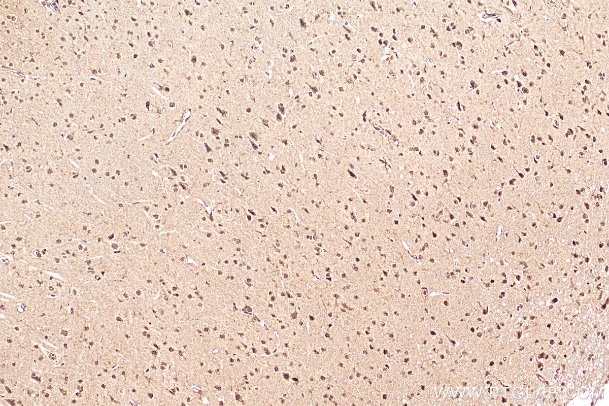 Immunohistochemistry (IHC) staining of rat brain tissue using NEUROD1 Polyclonal antibody (12081-1-AP)
