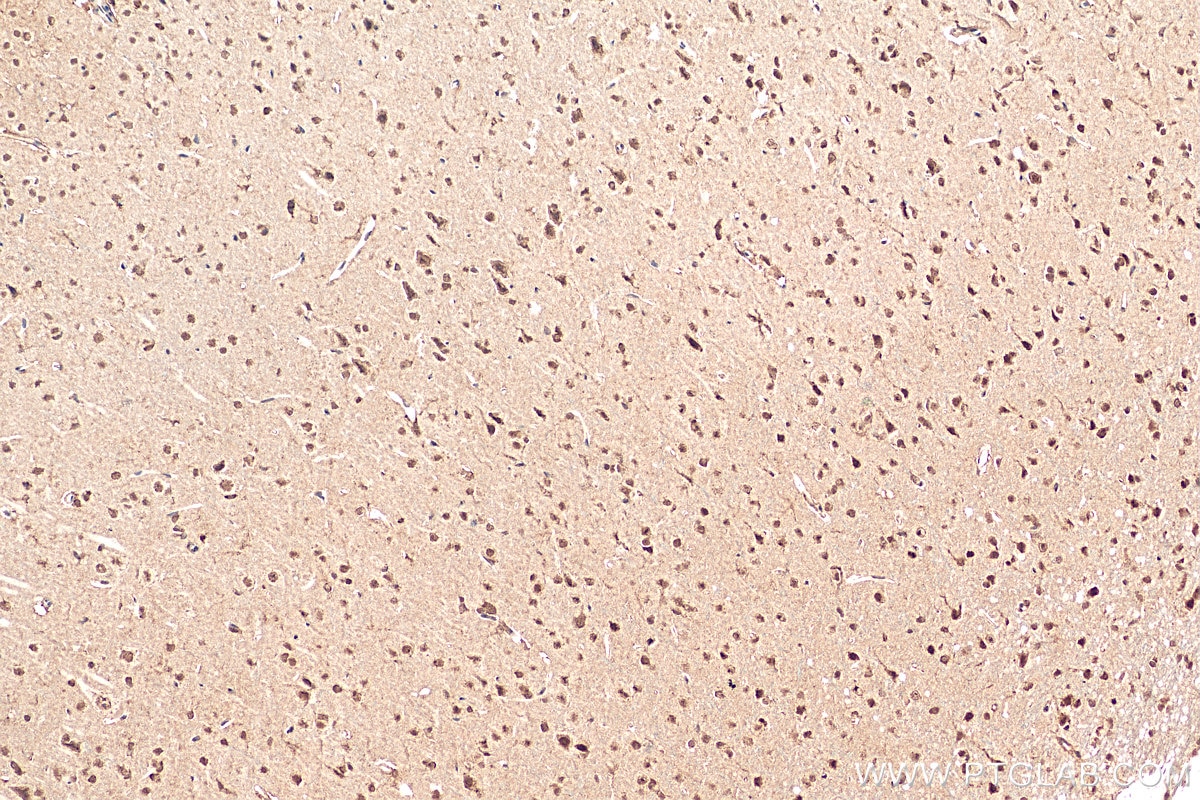 IHC staining of rat brain using 12081-1-AP