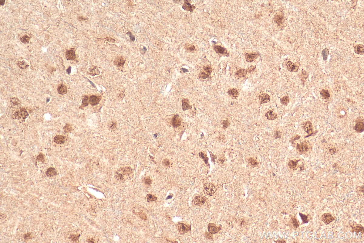 Immunohistochemistry (IHC) staining of rat brain tissue using NEUROD1 Polyclonal antibody (12081-1-AP)