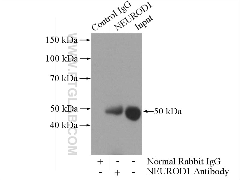 Immunoprecipitation (IP) experiment of Y79 cells using NEUROD1 Polyclonal antibody (12081-1-AP)