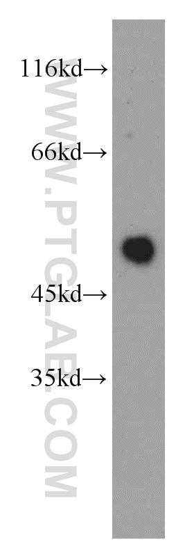 NEUROD1 Polyclonal antibody