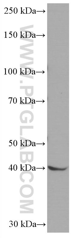 Western Blot (WB) analysis of SH-SY5Y cells using NEUROD1 Monoclonal antibody (66691-1-Ig)