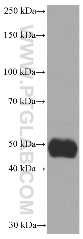 Western Blot (WB) analysis of Y79 cells using NEUROD1 Monoclonal antibody (66691-1-Ig)