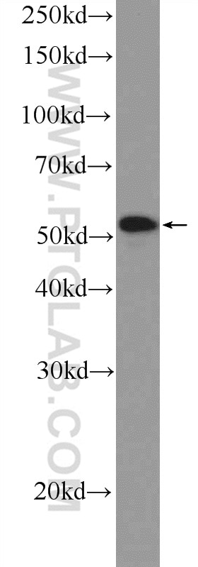 Western Blot (WB) analysis of Neuro-2a cells using NEUROD4 Polyclonal antibody (14610-1-AP)