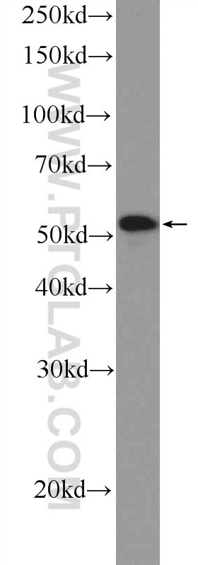 Western Blot (WB) analysis of Neuro-2a cells using NEUROD4 Polyclonal antibody (14610-1-AP)