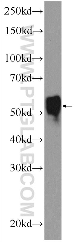 Western Blot (WB) analysis of Y79 cells using NEUROD4 Polyclonal antibody (14610-1-AP)