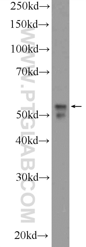 Western Blot (WB) analysis of Y79 cells using NEUROD4 Polyclonal antibody (14610-1-AP)