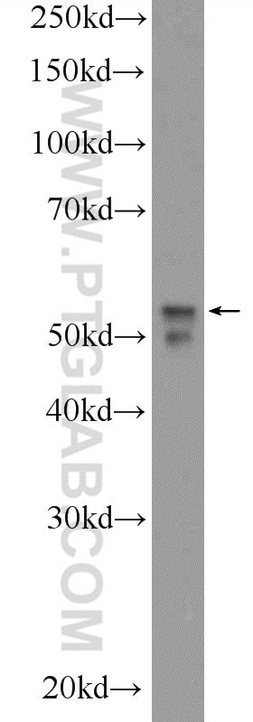 WB analysis of Y79 using 14610-1-AP