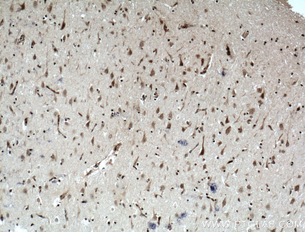 Immunohistochemistry (IHC) staining of human brain tissue using NEUROG1 Polyclonal antibody (12314-1-AP)