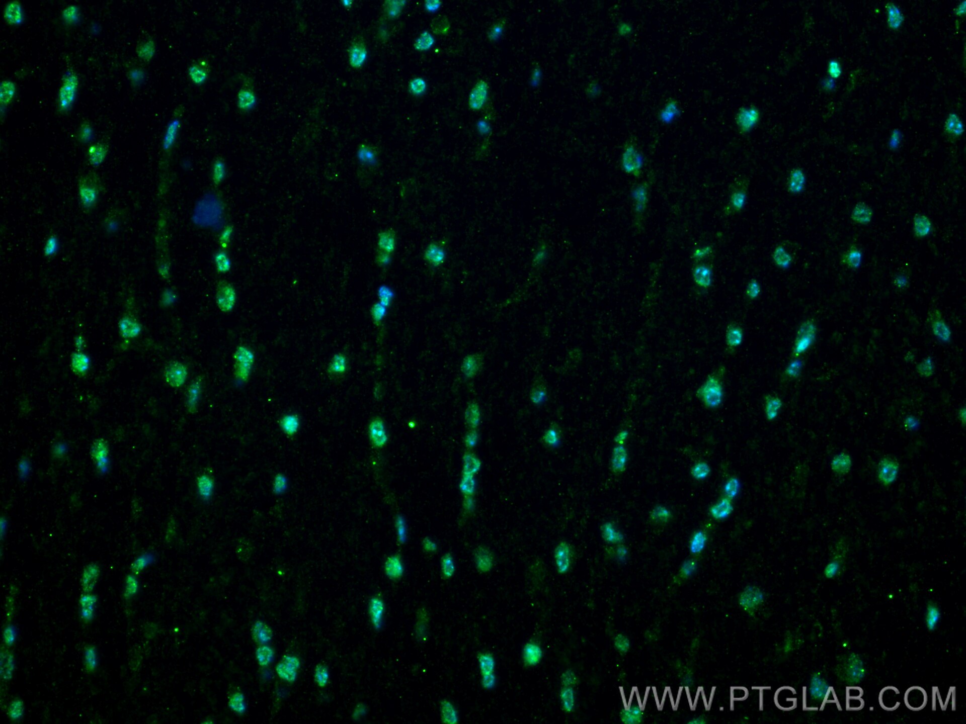 NEUROG1