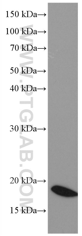 Western Blot (WB) analysis of mouse brain tissue using NEUROG1 Monoclonal antibody (66642-1-Ig)