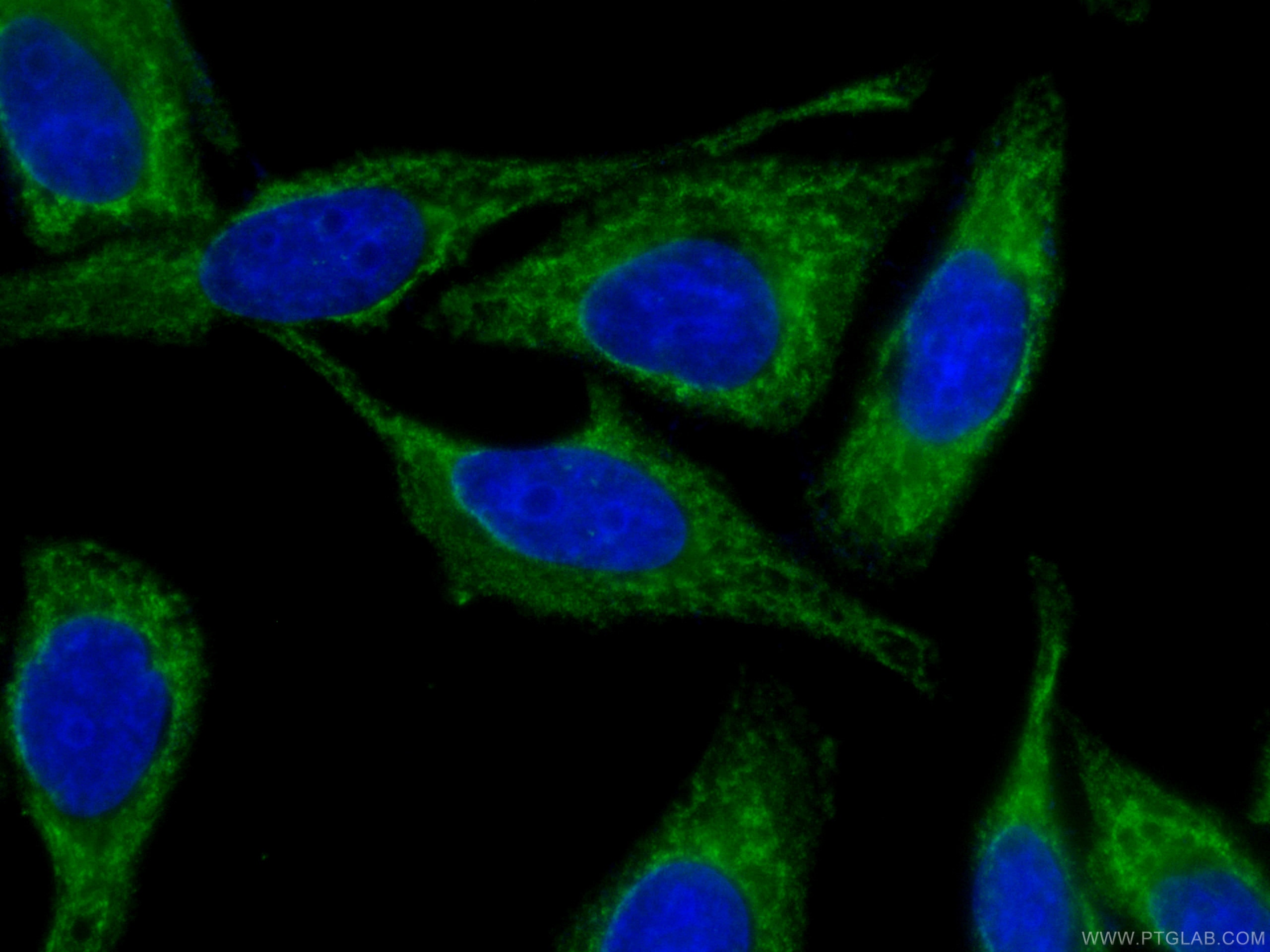Immunofluorescence (IF) / fluorescent staining of HepG2 cells using CoraLite® Plus 488-conjugated NF-κB p65 Monoclonal (CL488-66535)