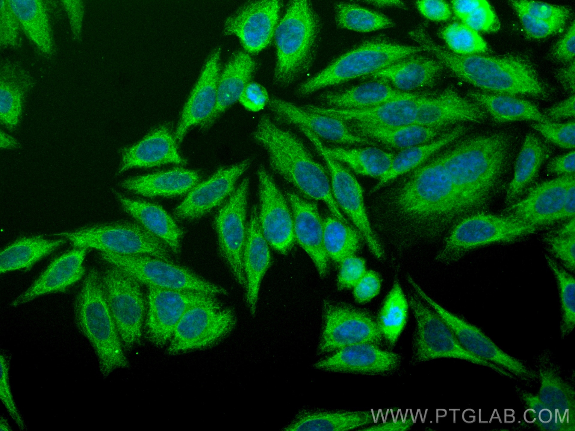 Immunofluorescence (IF) / fluorescent staining of HepG2 cells using NF-κB p65 Recombinant antibody (80979-1-RR)