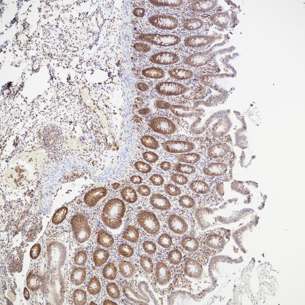Immunohistochemistry (IHC) staining of human colon tissue using NF-κB p65 Recombinant monoclonal antibody (80979-1-RR)