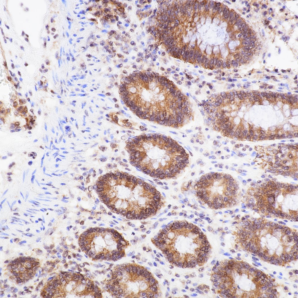Immunohistochemistry (IHC) staining of human colon tissue using NF-κB p65 Recombinant monoclonal antibody (80979-1-RR)