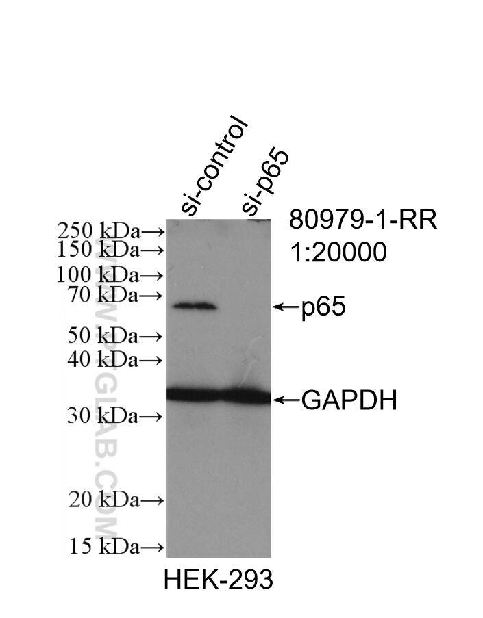 Western Blot (WB) analysis of HEK-293 cells using NF-κB p65 Recombinant antibody (80979-1-RR)