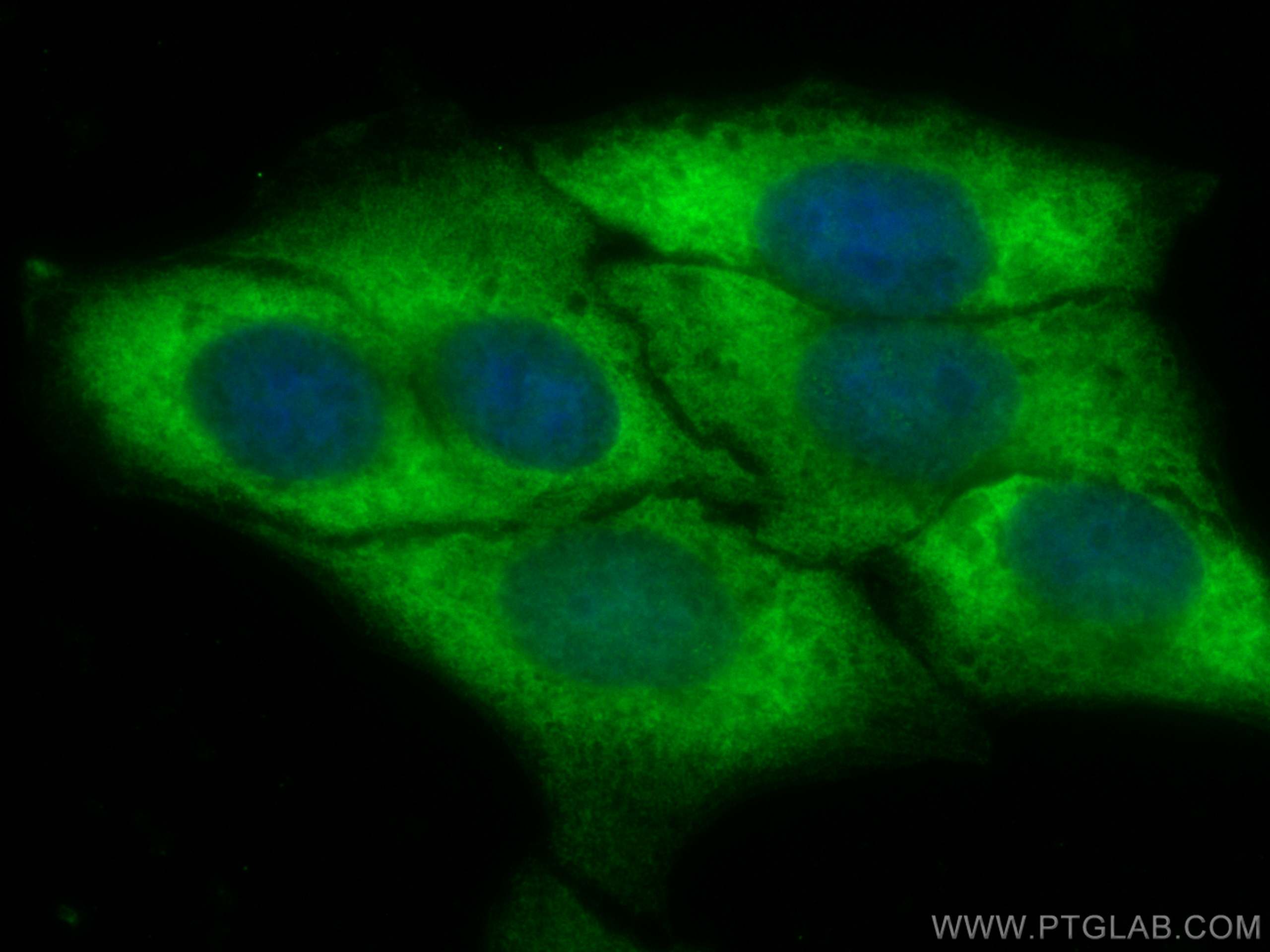 Immunofluorescence (IF) / fluorescent staining of HepG2 cells using CoraLite® Plus 488-conjugated NF-κB p65 Recombinan (CL488-80979)