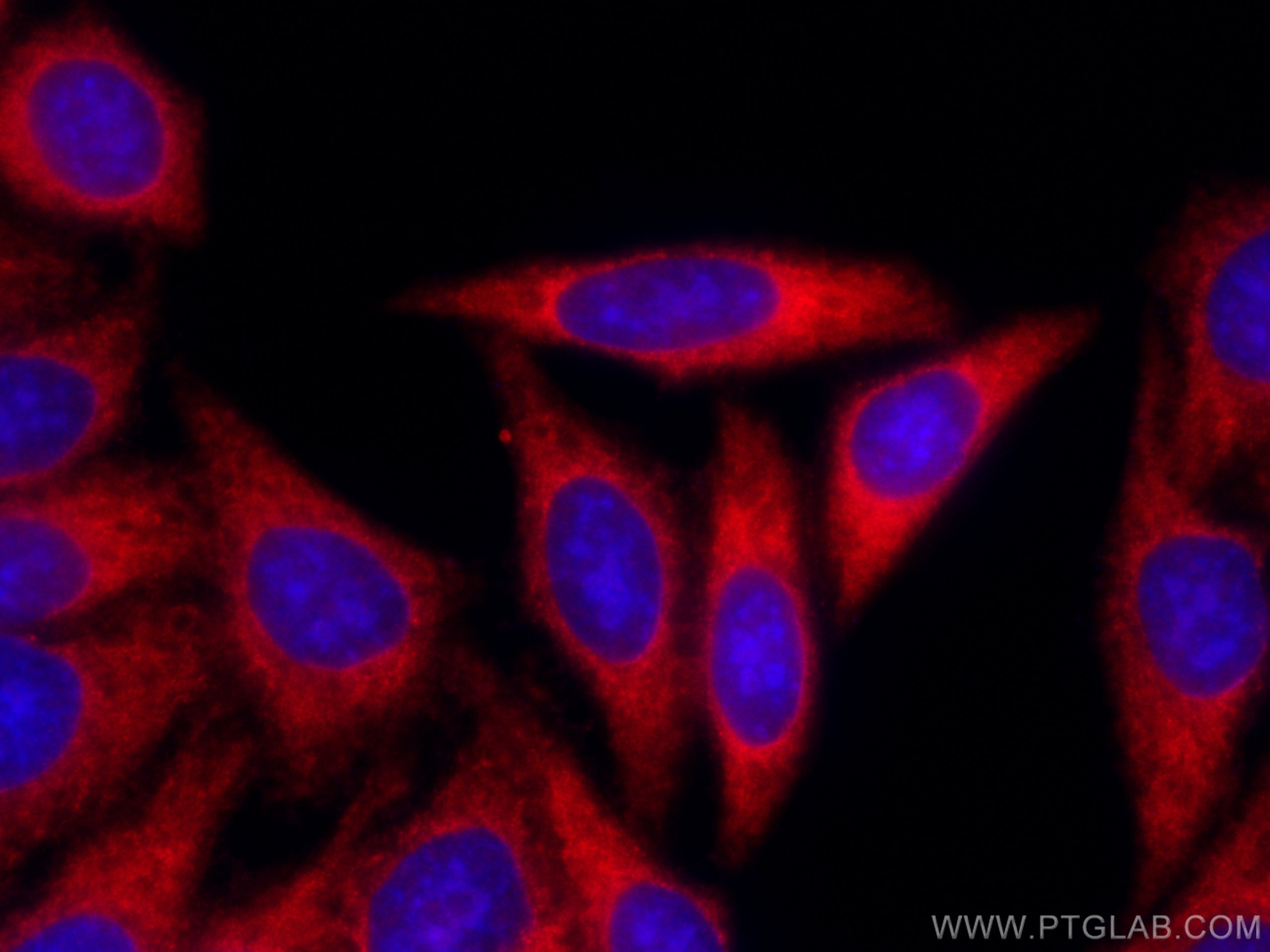 Immunofluorescence (IF) / fluorescent staining of HepG2 cells using CoraLite®594-conjugated NF-κB p65 Polyclonal antib (CL594-10745)