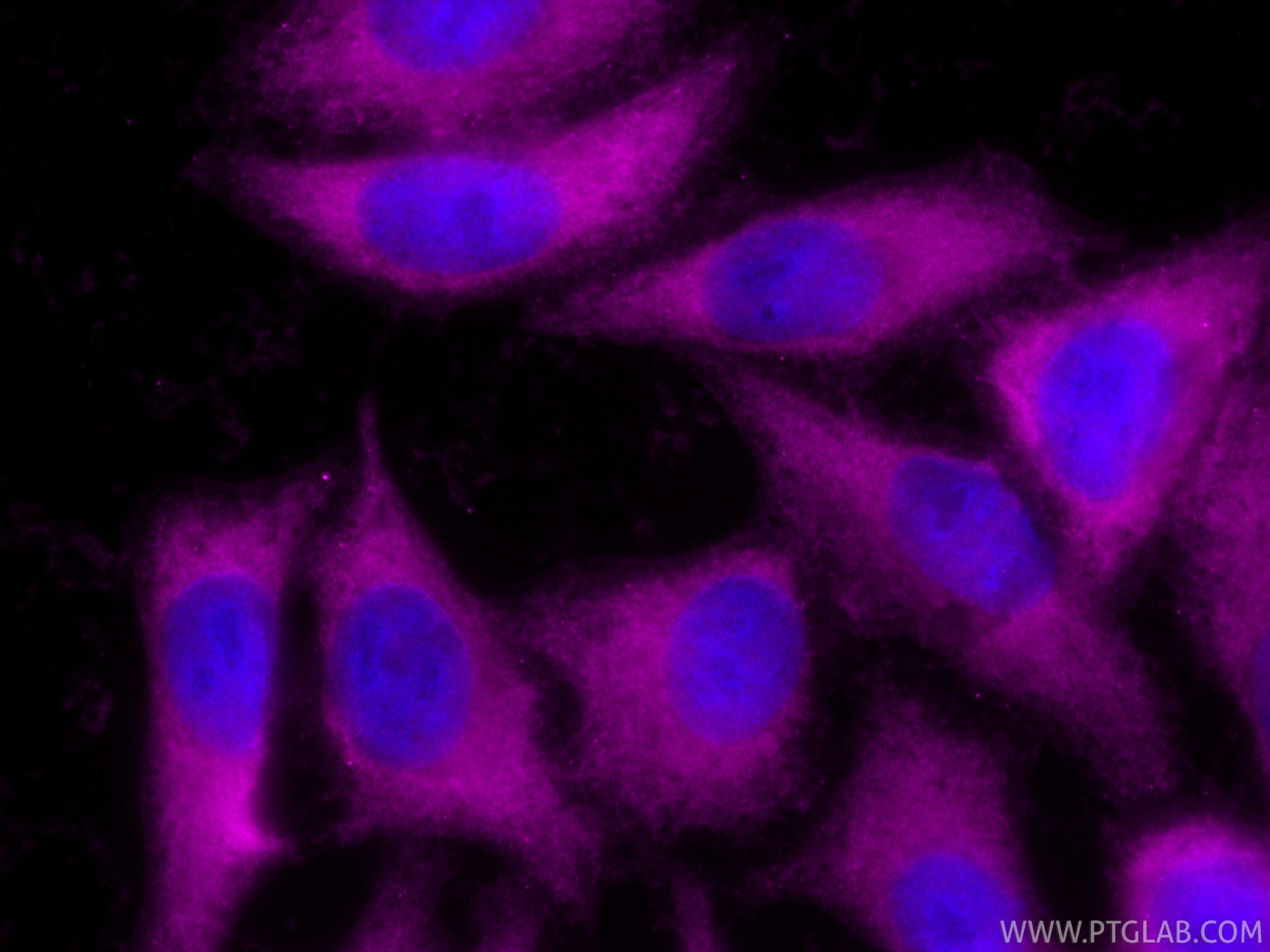 Immunofluorescence (IF) / fluorescent staining of HepG2 cells using CoraLite® Plus 647-conjugated NF-κB p65 Recombinan (CL647-80979)