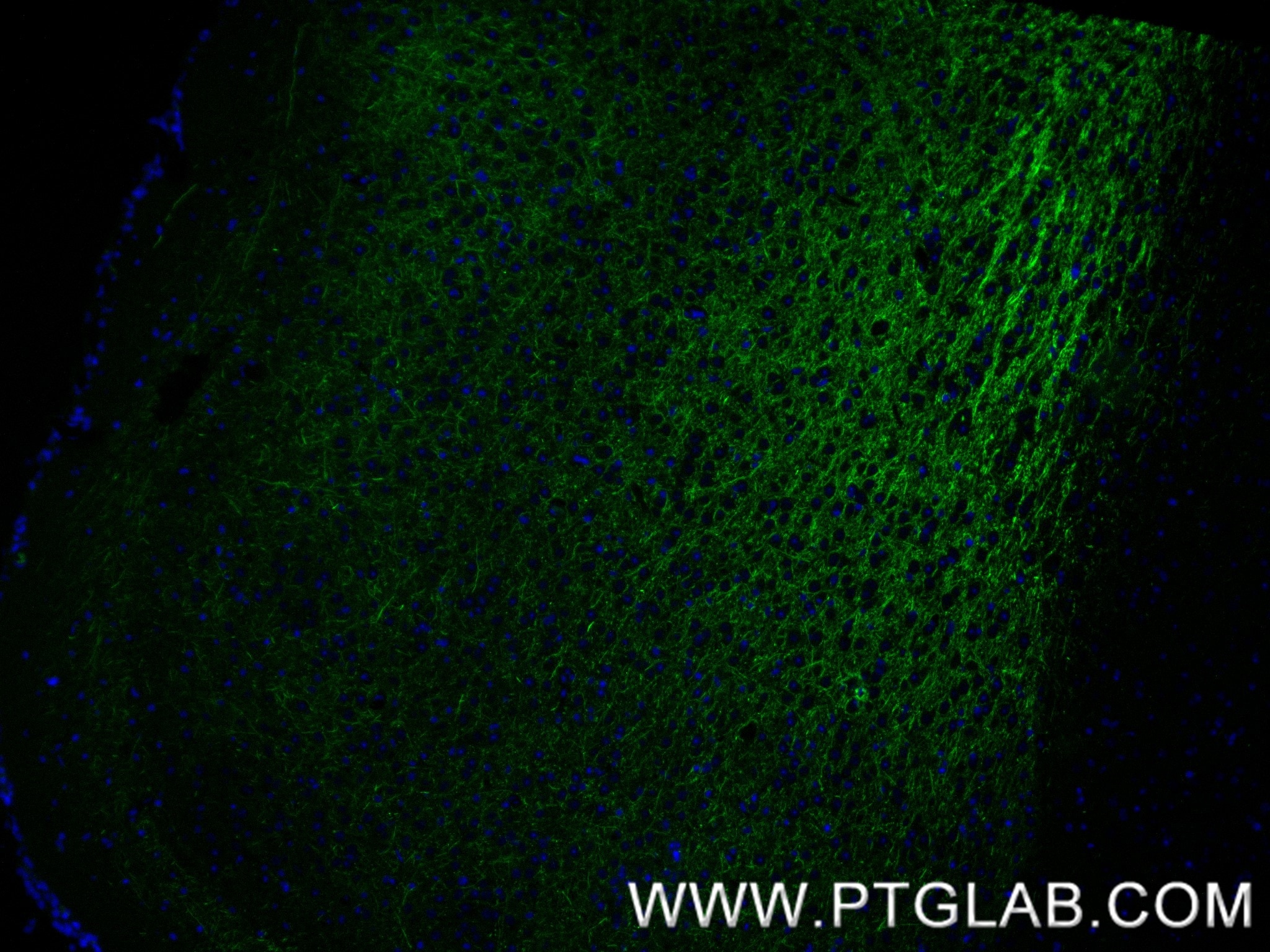 IF Staining of mouse brain using 87694-1-RR (same clone as 87694-1-PBS) Immunofluorescence (IF) / fluorescent staining of mouse brain tissue using NF-L Recombinant monoclonal antibody (87694-1-RR)
