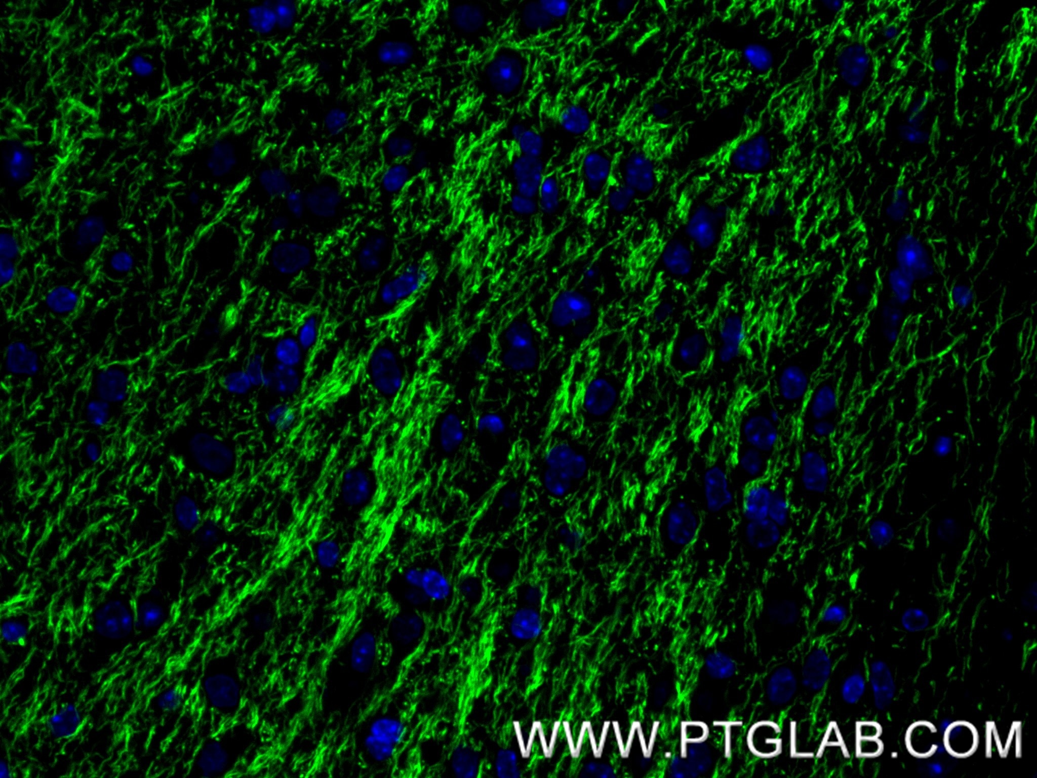 IF Staining of mouse brain using 87694-1-RR (same clone as 87694-1-PBS) Immunofluorescence (IF) / fluorescent staining of mouse brain tissue using NF-L Recombinant monoclonal antibody (87694-1-RR)