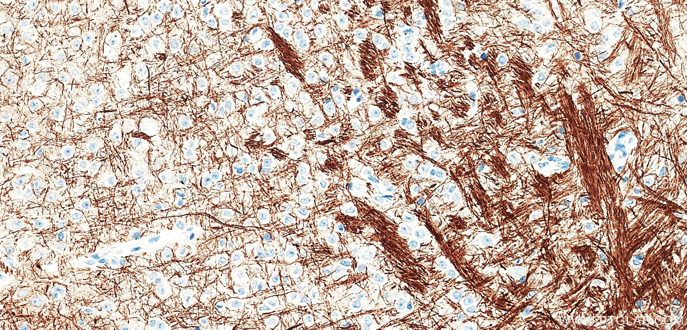 IHC staining of mouse brain using 87694-1-RR (same clone as 87694-1-PBS) Immunohistochemistry (IHC) staining of mouse brain tissue using NF-L Recombinant monoclonal antibody (87694-1-RR)
