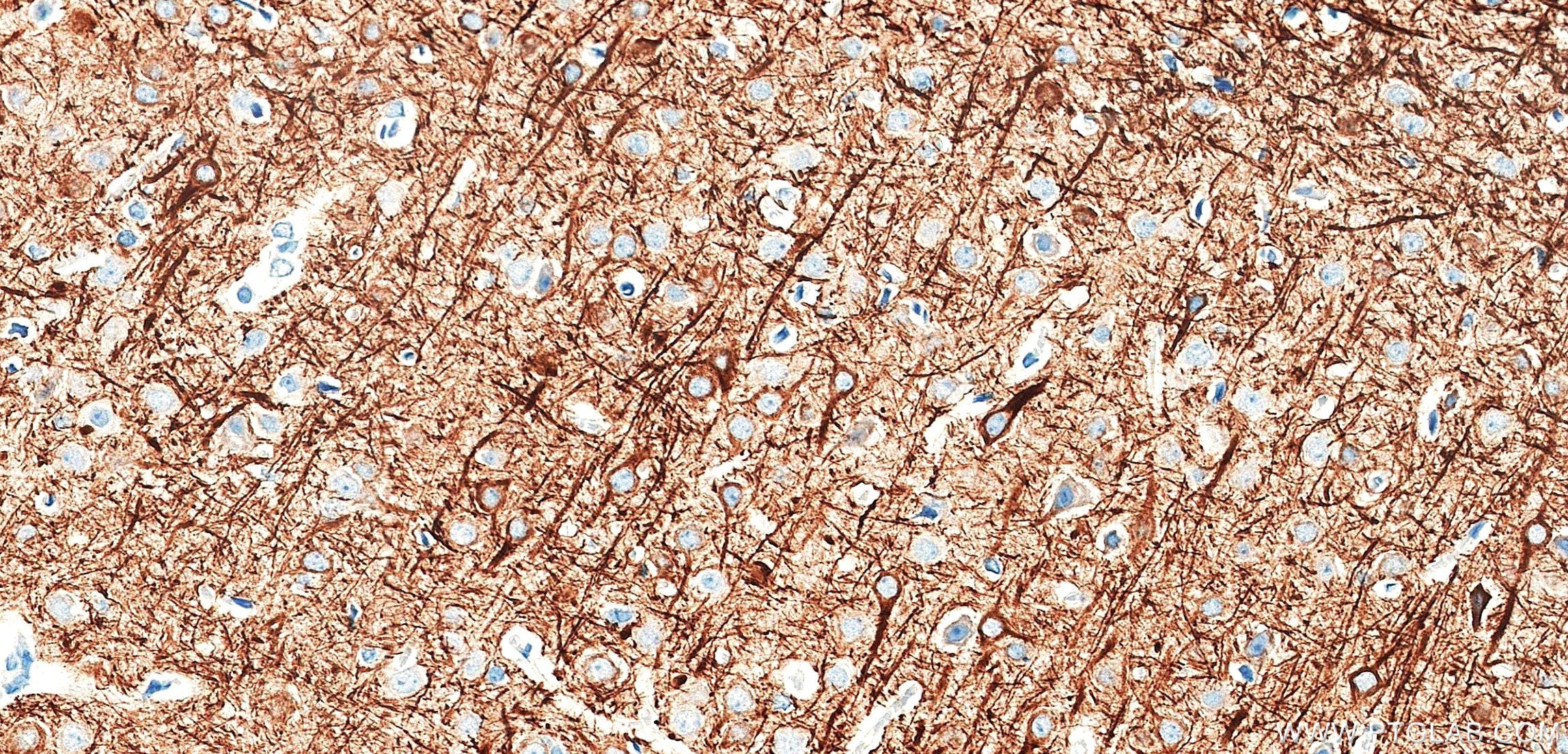 IHC staining of rat brain using 87694-1-RR (same clone as 87694-1-PBS) Immunohistochemistry (IHC) staining of rat brain tissue using NF-L Recombinant monoclonal antibody (87694-1-RR)