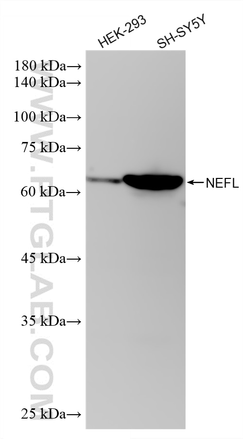 WB analysis using 87694-1-RR (same clone as 87694-1-PBS) Western Blot (WB) analysis of various lysates using NF-L Recombinant monoclonal antibody (87694-1-RR)