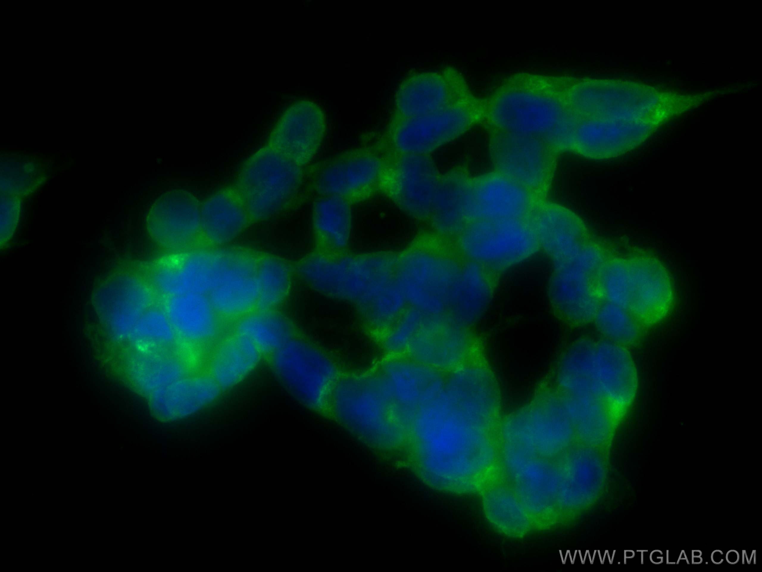 Immunofluorescence (IF) / fluorescent staining of SH-SY5Y cells using CoraLite® Plus 488-conjugated NF-L Polyclonal anti (CL488-12998)