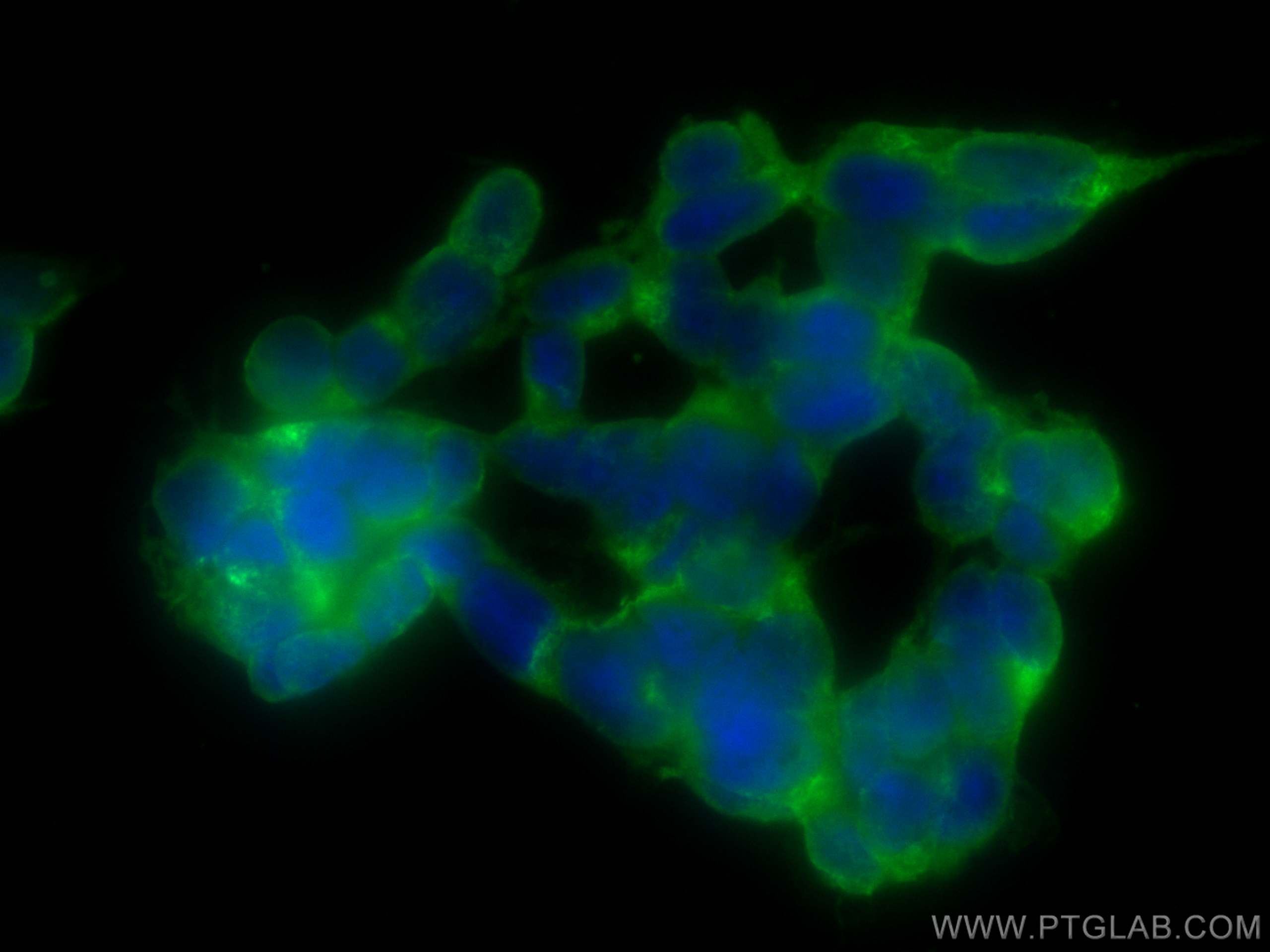 IF Staining of SH-SY5Y using CL488-12998