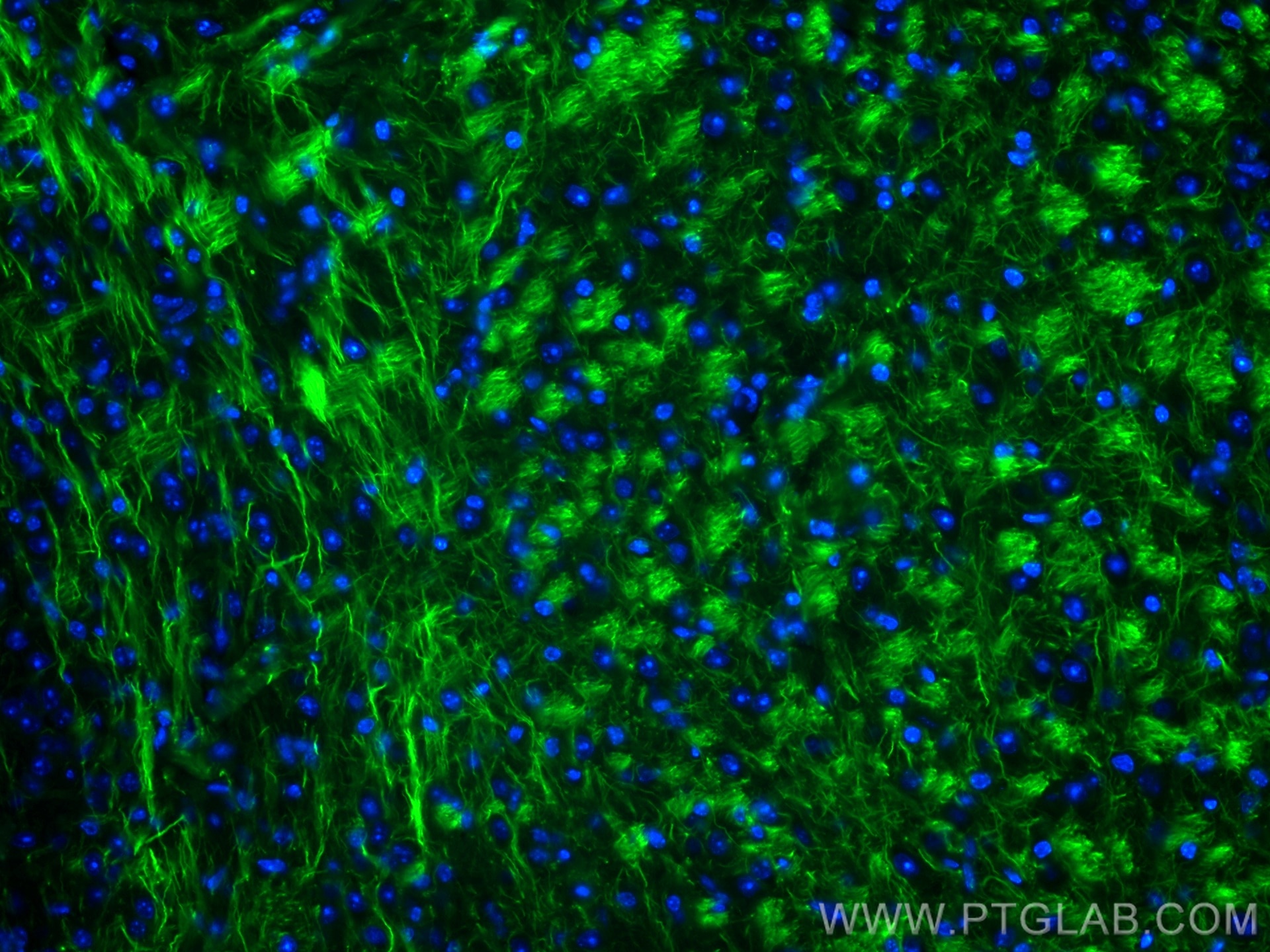 Immunofluorescence (IF) / fluorescent staining of mouse brain tissue using CoraLite® Plus 488-conjugated NF-L Monoclonal anti (CL488-60189)