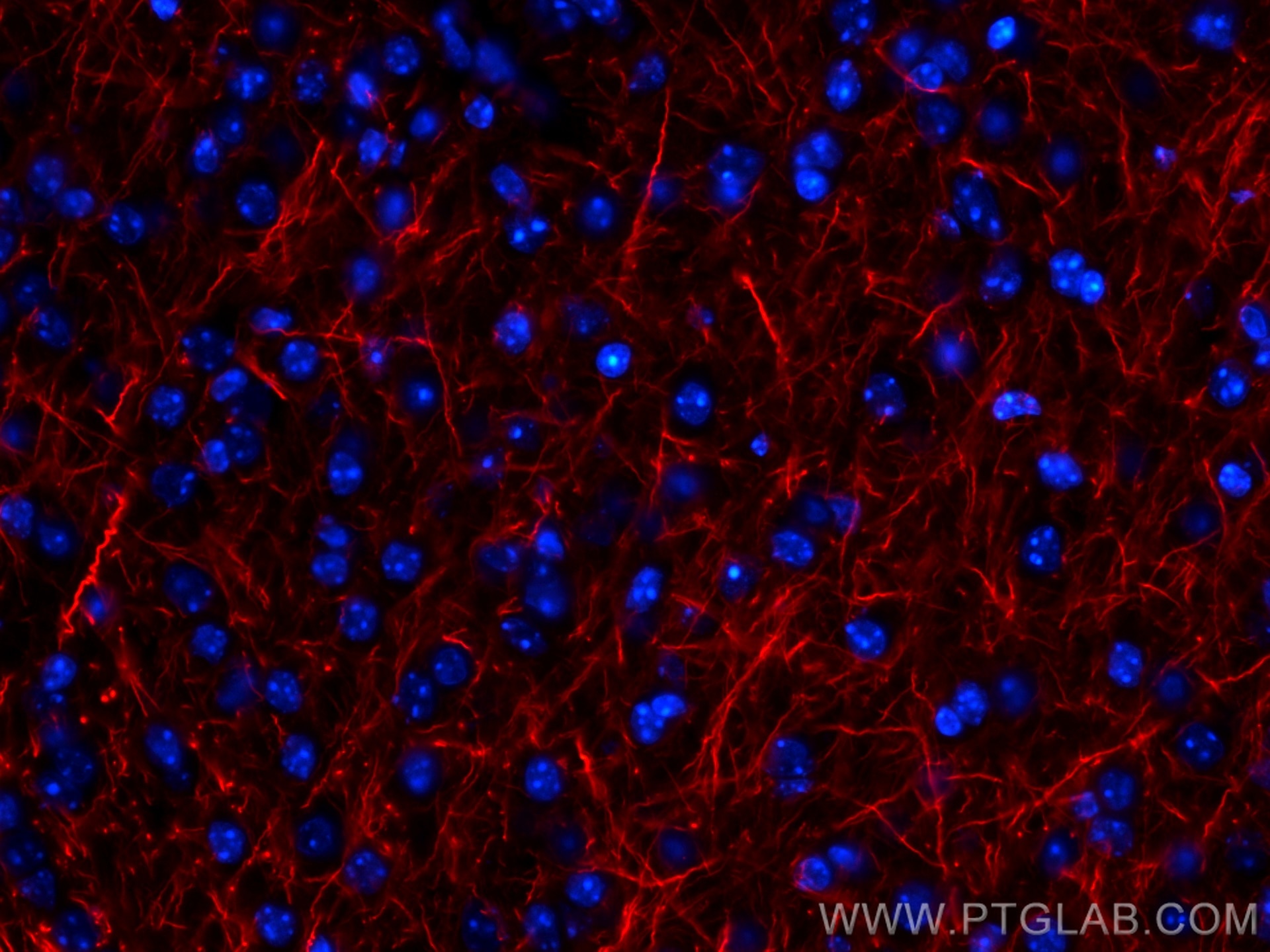 Immunofluorescence (IF) / fluorescent staining of mouse brain tissue using CoraLite®594-conjugated NF-L Monoclonal antibody (CL594-60189)