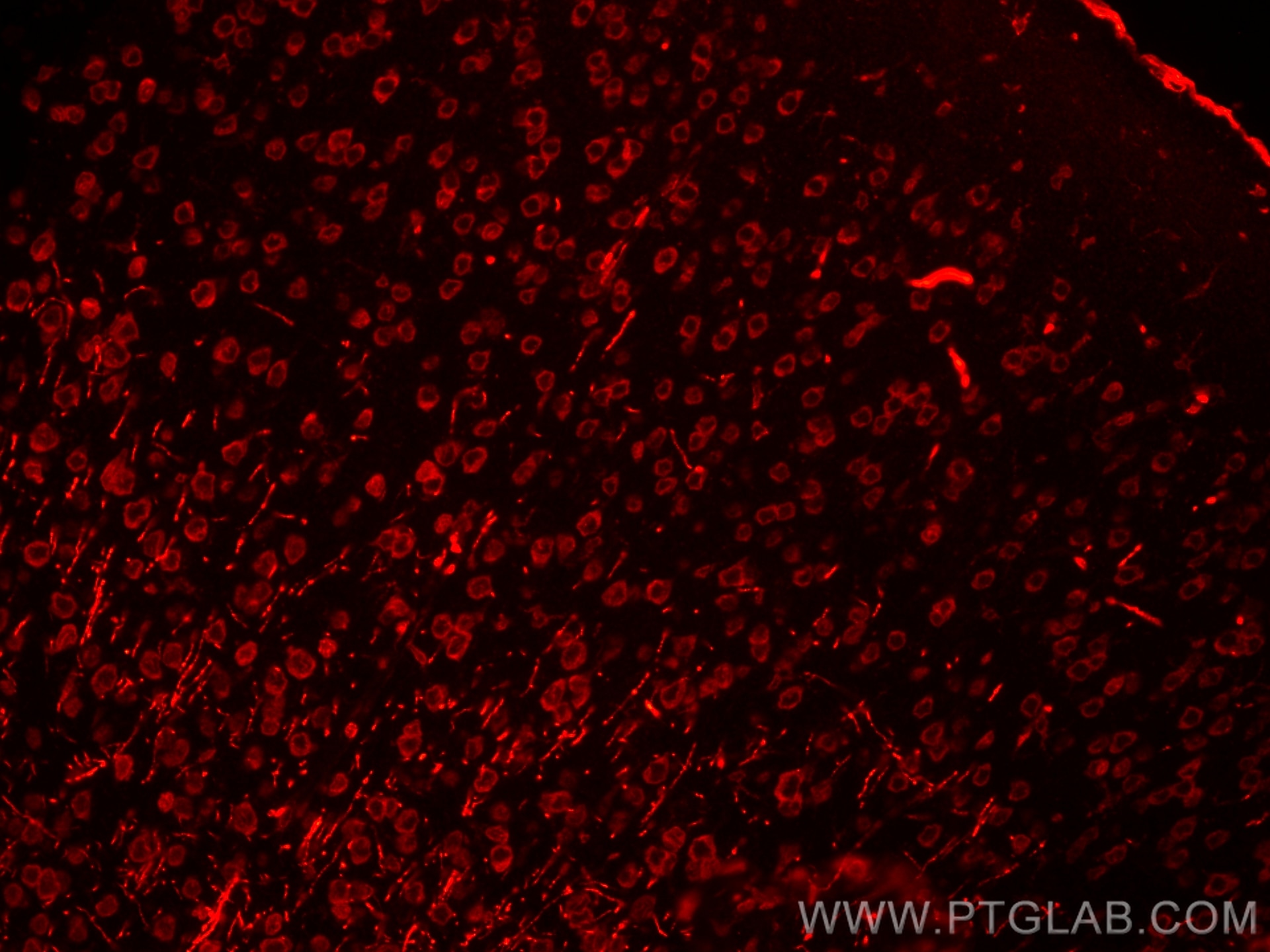 Immunofluorescence (IF) / fluorescent staining of mouse brain tissue using CoraLite®594-conjugated NF-M Monoclonal antibody (CL594-66396)