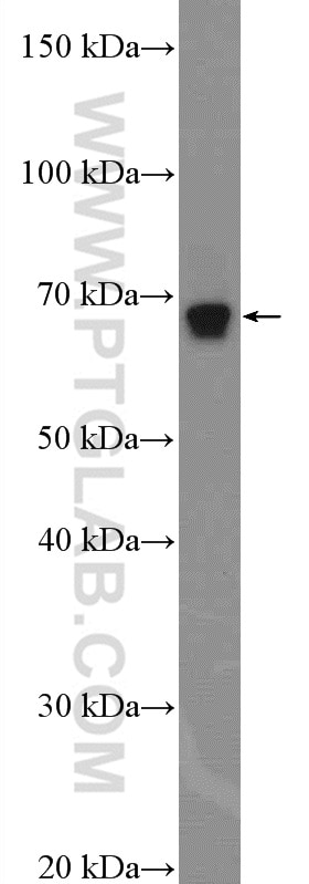 Western Blot (WB) analysis of mouse kidney tissue using NF2 Polyclonal antibody (10659-1-AP)