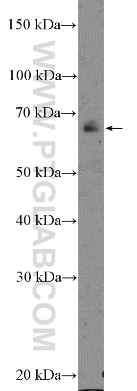 Western Blot (WB) analysis of Jurkat cells using NF2 Polyclonal antibody (10659-1-AP)