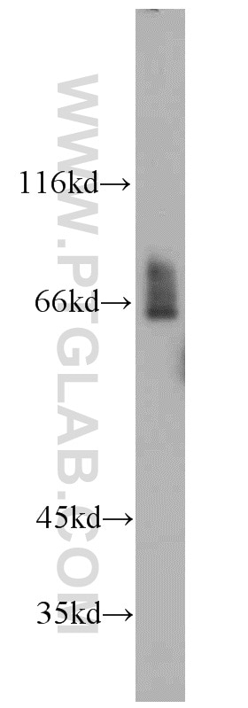 Western Blot (WB) analysis of NIH/3T3 cells using NF2 Polyclonal antibody (10659-1-AP)