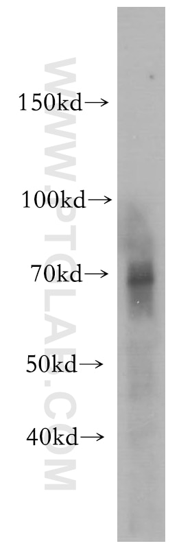 Western Blot (WB) analysis of human kidney tissue using NF2 Polyclonal antibody (10659-1-AP)