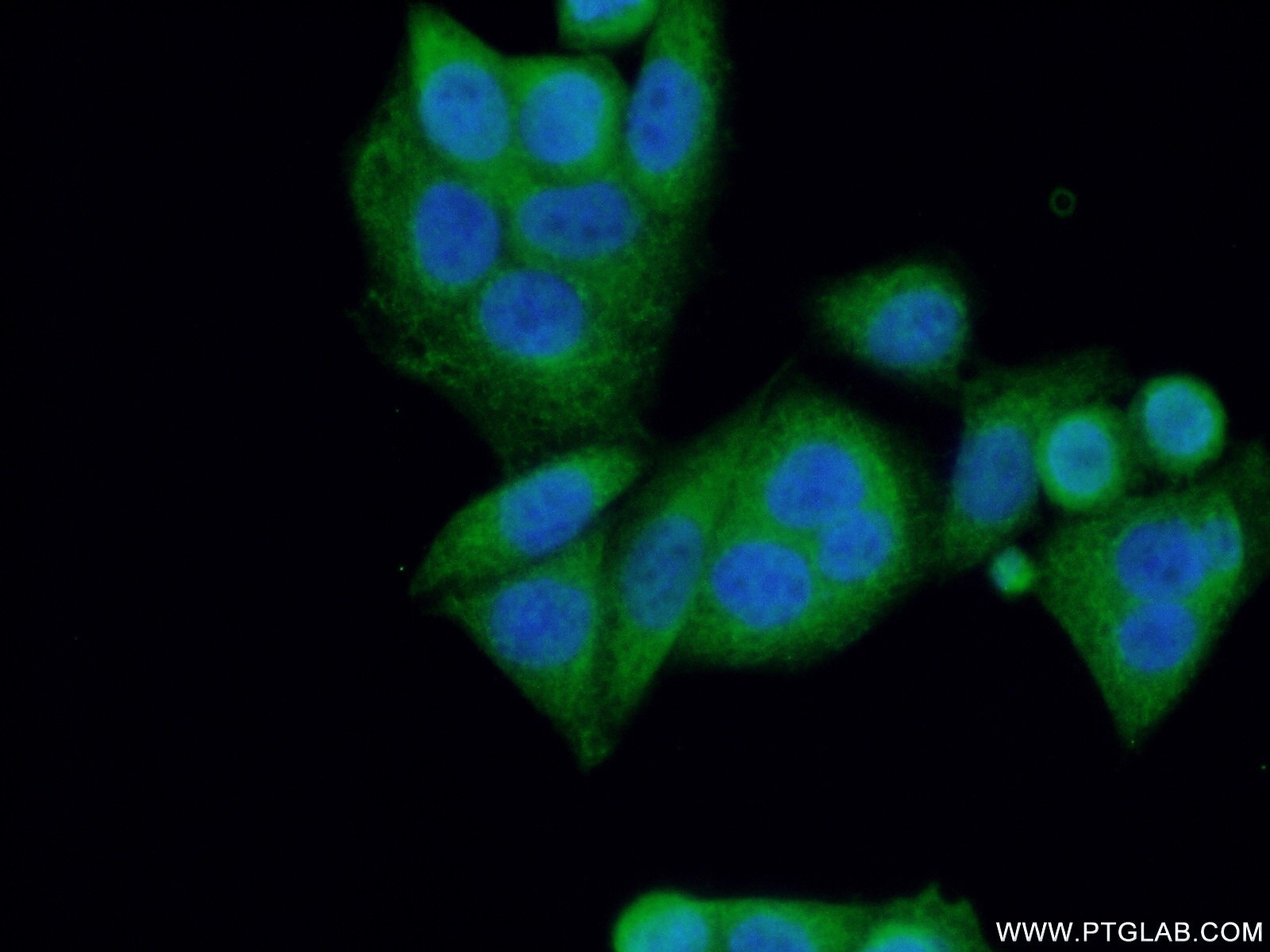 Immunofluorescence (IF) / fluorescent staining of HeLa cells using NF2 Polyclonal antibody (21686-1-AP)