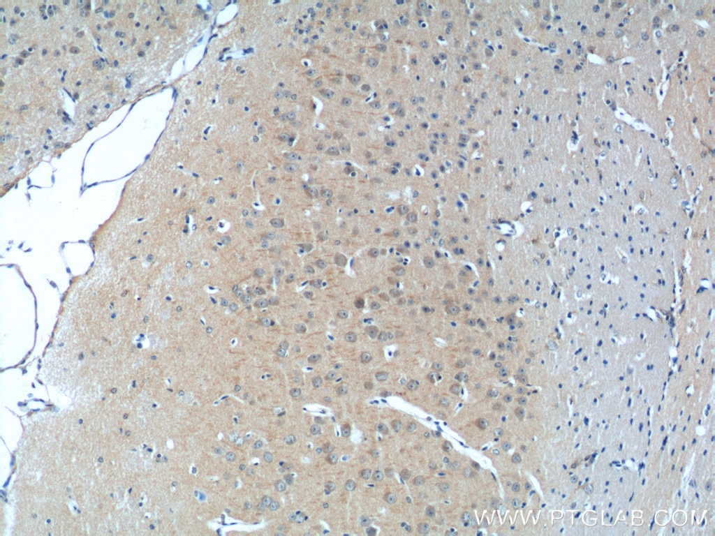 IHC staining of mouse brain using 21686-1-AP