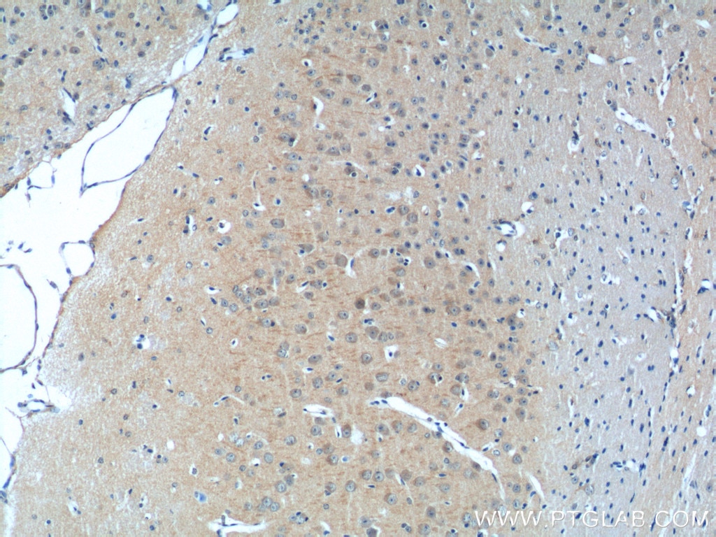 Immunohistochemistry (IHC) staining of mouse brain tissue using NF2 Polyclonal antibody (21686-1-AP)