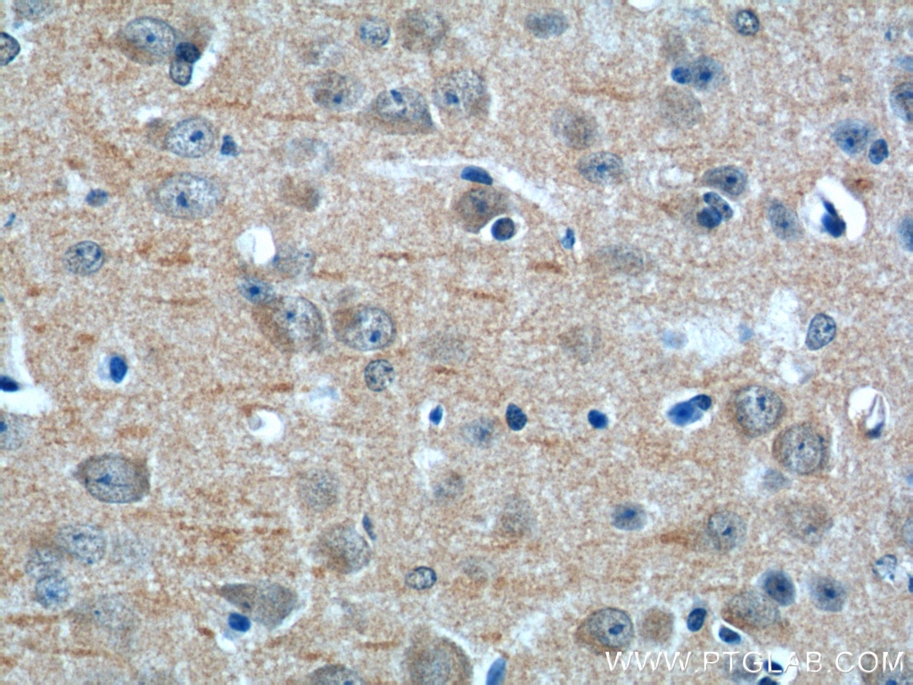 Immunohistochemistry (IHC) staining of mouse brain tissue using NF2 Polyclonal antibody (21686-1-AP)