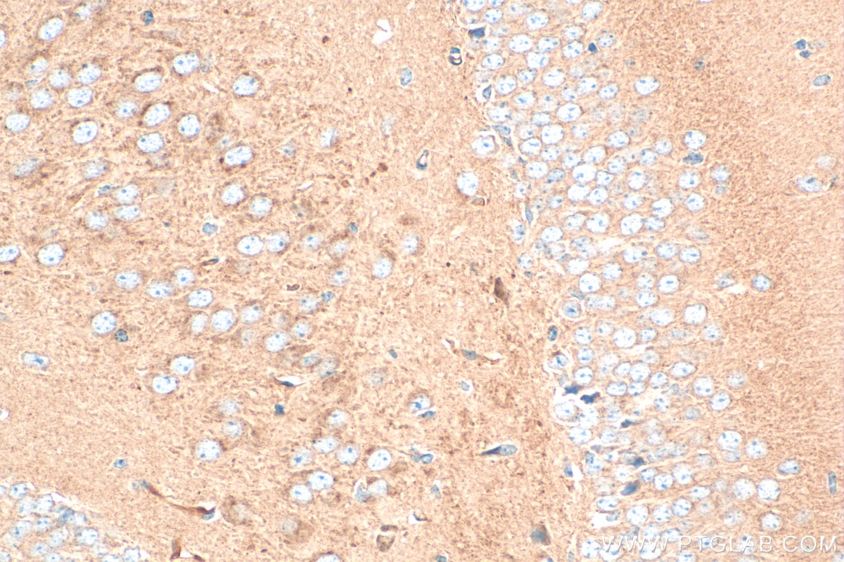 Immunohistochemistry (IHC) staining of mouse brain tissue using NF2 Polyclonal antibody (21686-1-AP)