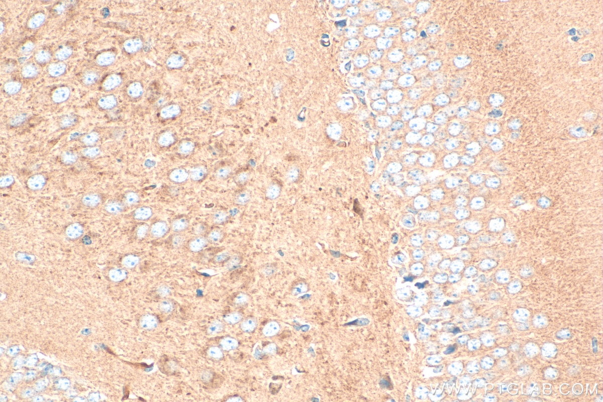 IHC staining of mouse brain using 21686-1-AP