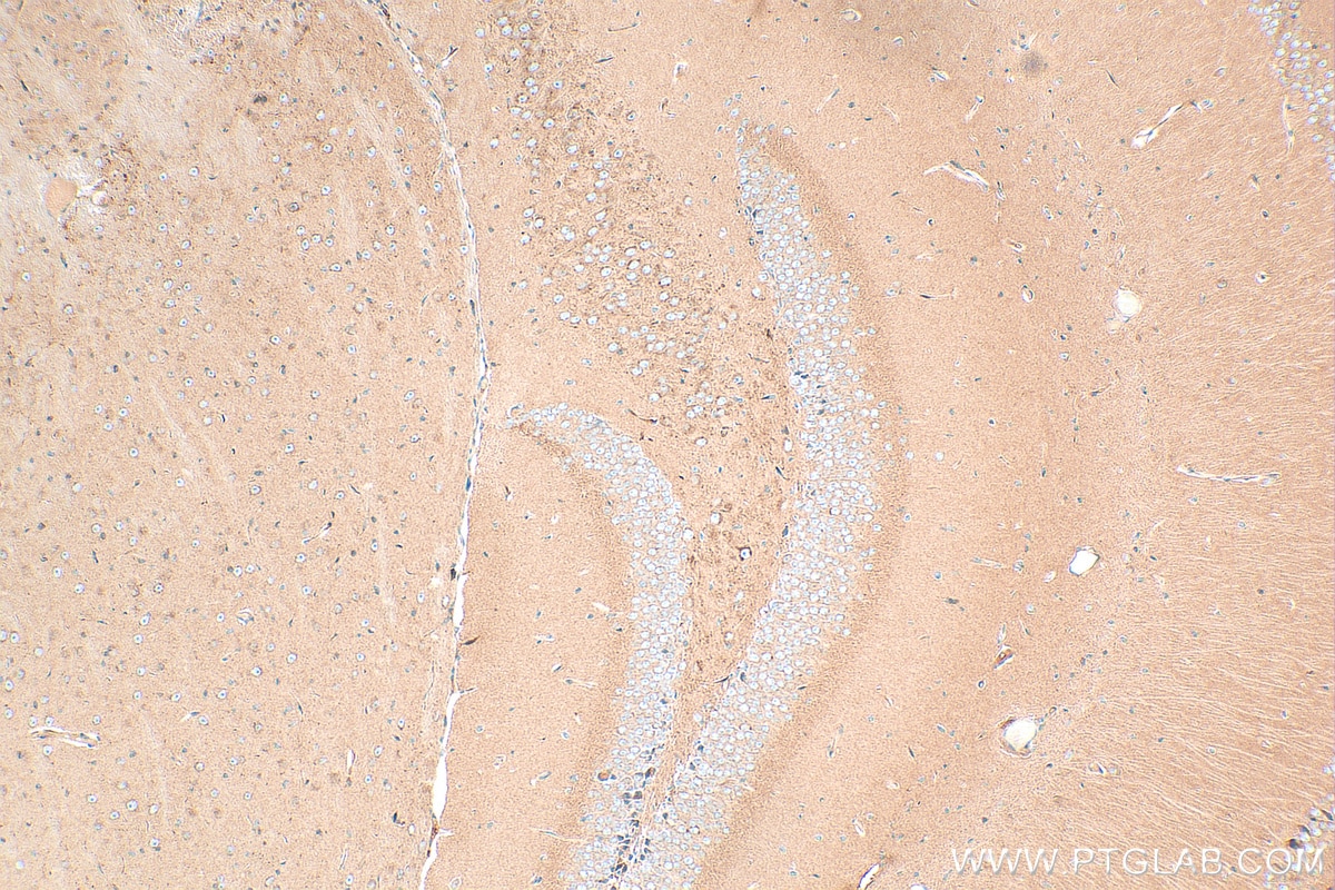 Immunohistochemistry (IHC) staining of mouse brain tissue using NF2 Polyclonal antibody (21686-1-AP)