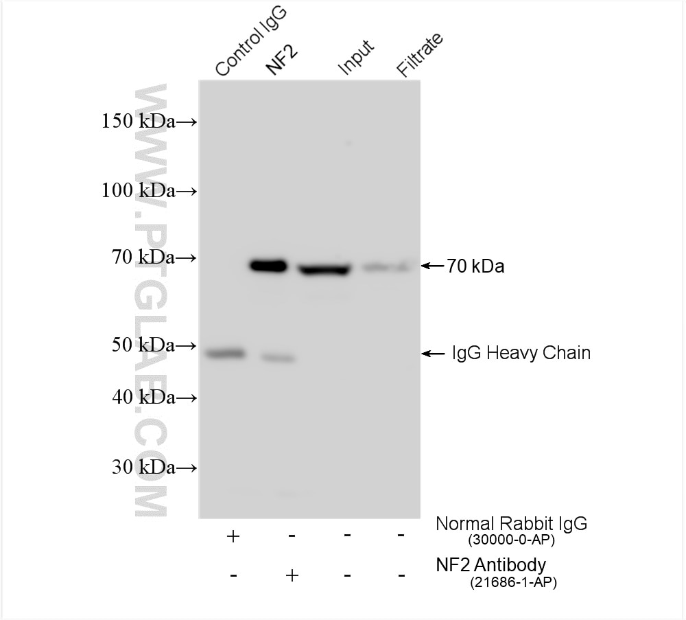 Immunoprecipitation (IP) experiment of HeLa cells using NF2 Polyclonal antibody (21686-1-AP)