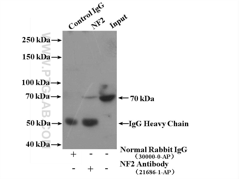 Immunoprecipitation (IP) experiment of HeLa cells using NF2 Polyclonal antibody (21686-1-AP)