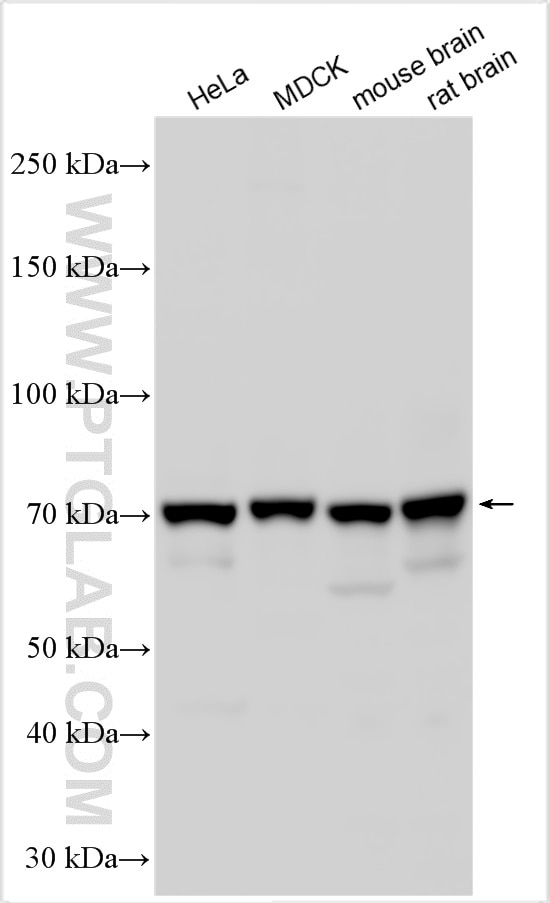 Western Blot (WB) analysis of various lysates using NF2 Polyclonal antibody (21686-1-AP)