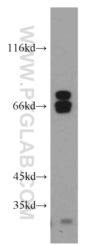 Western Blot (WB) analysis of HeLa cells using NF2 Polyclonal antibody (21686-1-AP)