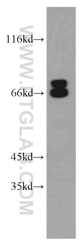 Western Blot (WB) analysis of HepG2 cells using NF2 Polyclonal antibody (21686-1-AP)