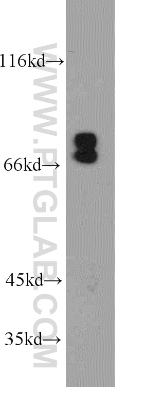 Western Blot (WB) analysis of MCF-7 cells using NF2 Polyclonal antibody (21686-1-AP)